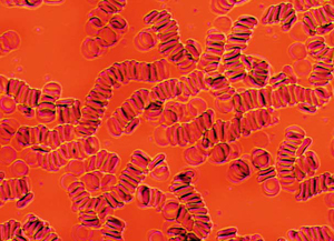 bioshield wyniki 3 vegamedica