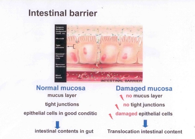 leaky gut syndrome3