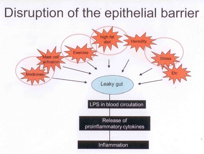 leaky gut syndrome5